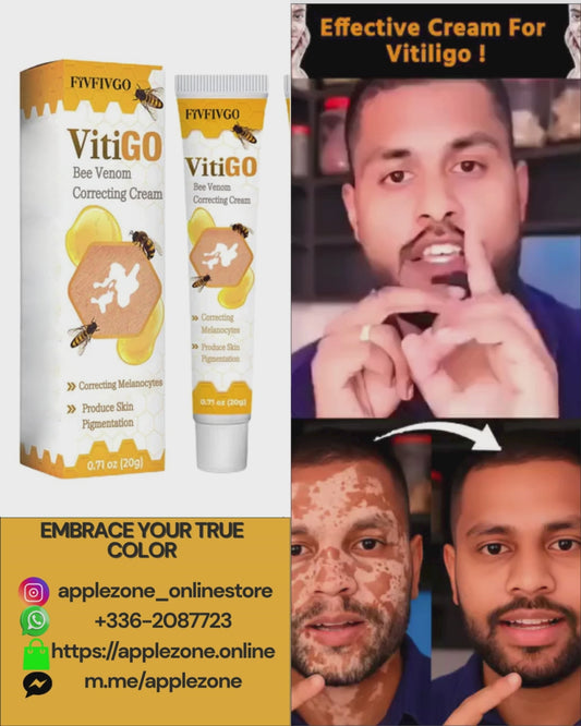 VITIGO CREAM -  helping reduce the contrast between depigmented patches and surrounding skin